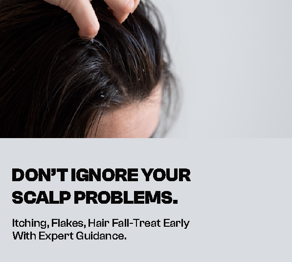 Best Clinic for Scalp Disorder Treatment in Mavoor Road, kozhikode – VCare Guide Best Clinic for Scalp Disorder Treatment in Mavoor Road, kozhikode – VCare Guide