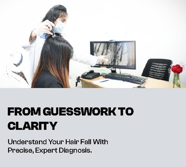 Hair Fall Test in Anna Nagar, madurai: Discover the Real Cause with VCare TrichoScan Analysis