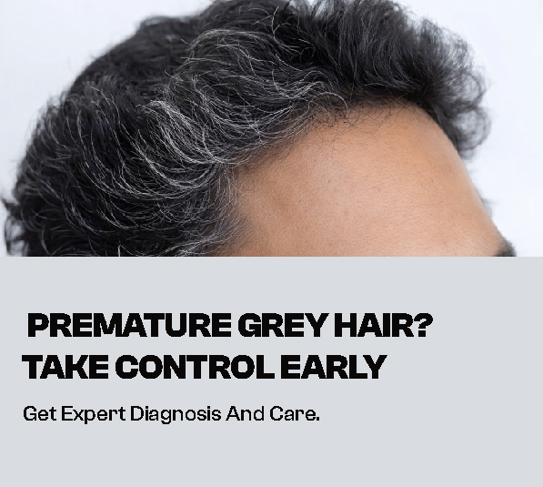 How to Treat Premature Grey Hair in Nadar Colony, coimbatore: Expert Guide by VCare Hair & Skin Clinic