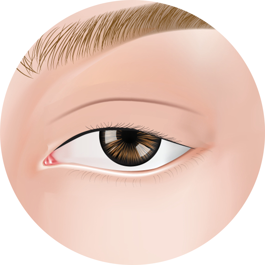 Oculoplasty Category