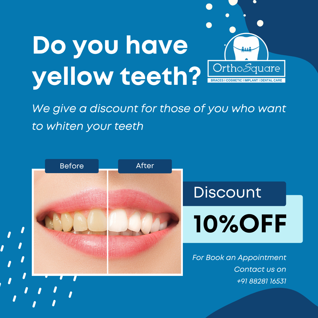 Say goodbye to yellow teeth and yes to a radiant smile!