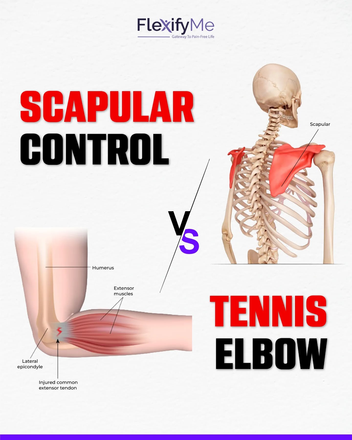 Most tennis elbow treatment fails for one simple reason