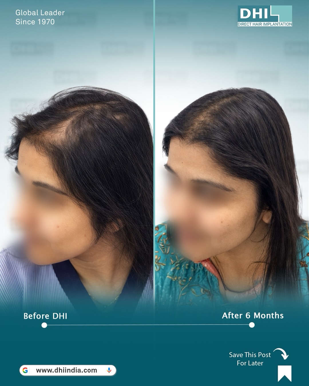 Before After