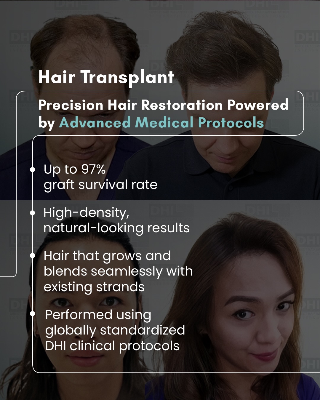Hair Transplant