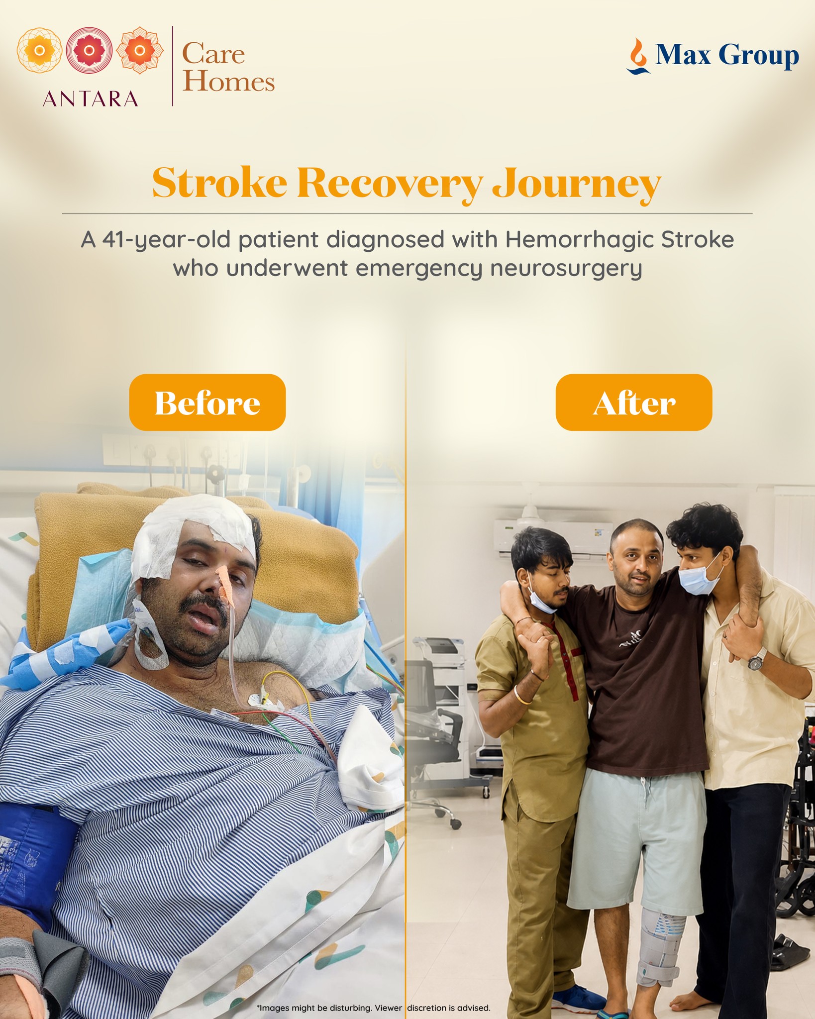 From emergency neurosurgery to taking assisted steps again - Sameer’s recovery journey