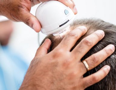 Alopecia Diagnostic Test Category