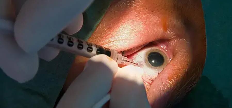 Best Eye Surgeon in Ozhuginasery, kanniyakumari: Trust Vasan Eye Care Experts
