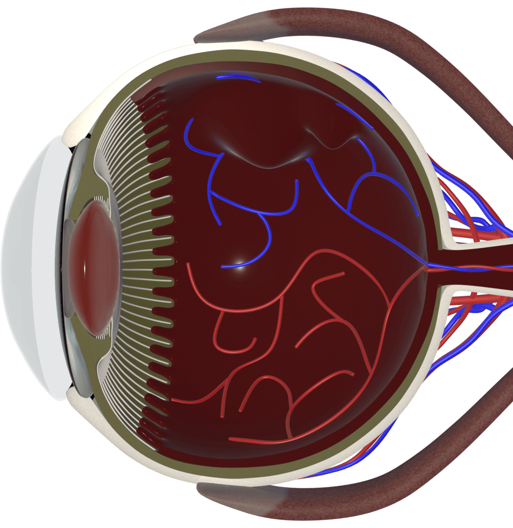 ICL Surgery Category
