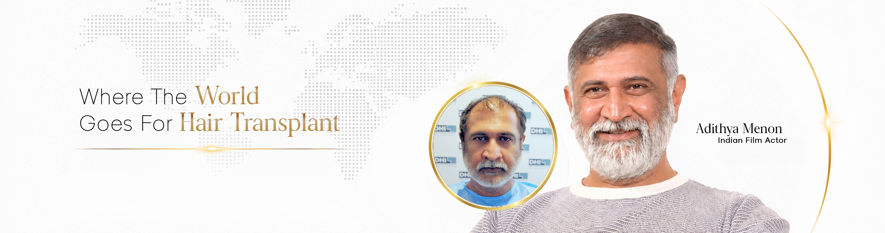 DHI® India - Best Hair Transplant