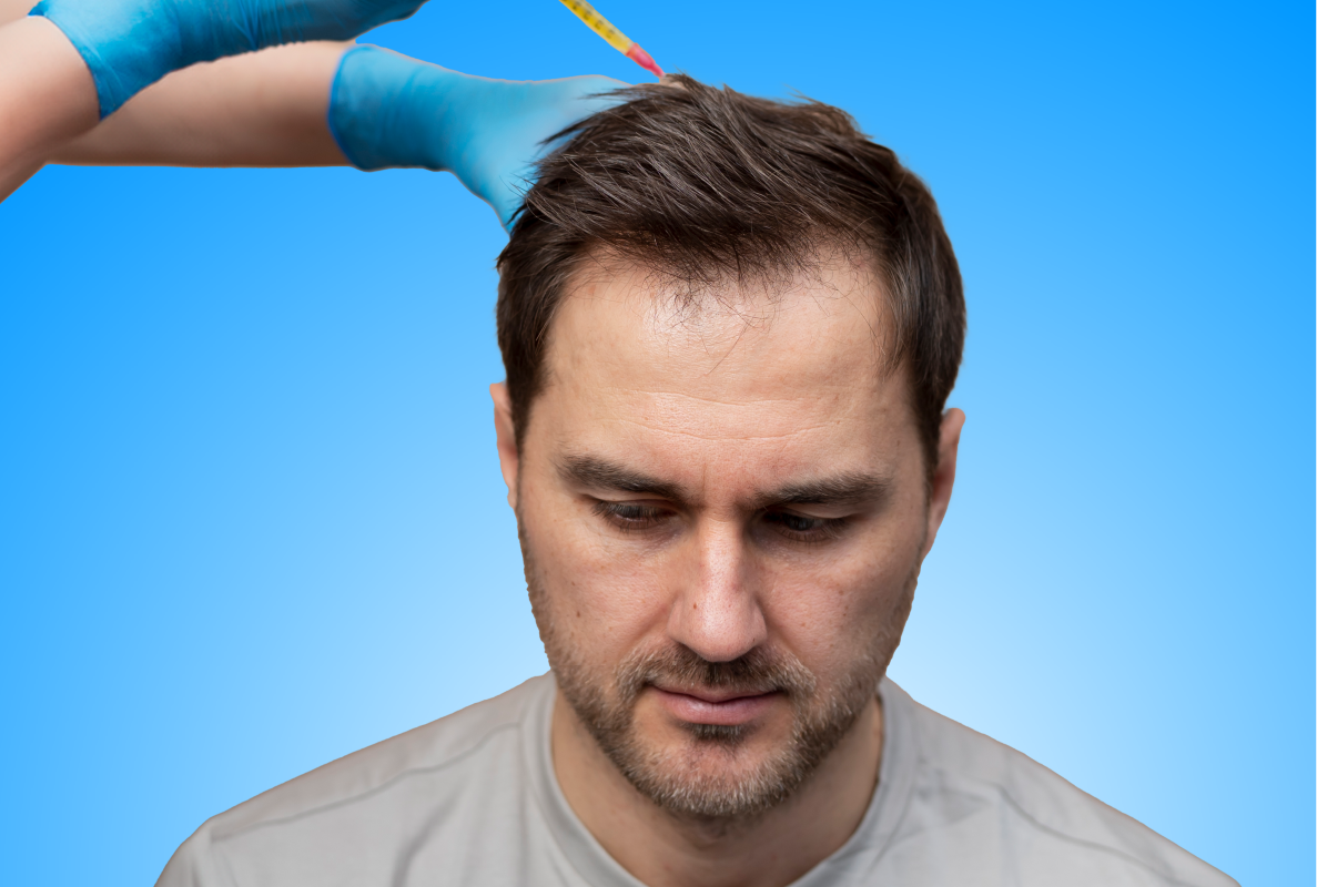 CellGraft Hair Growth Treatment
