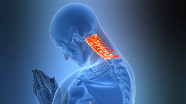 Cervical Spinal Canal Stenosis Category