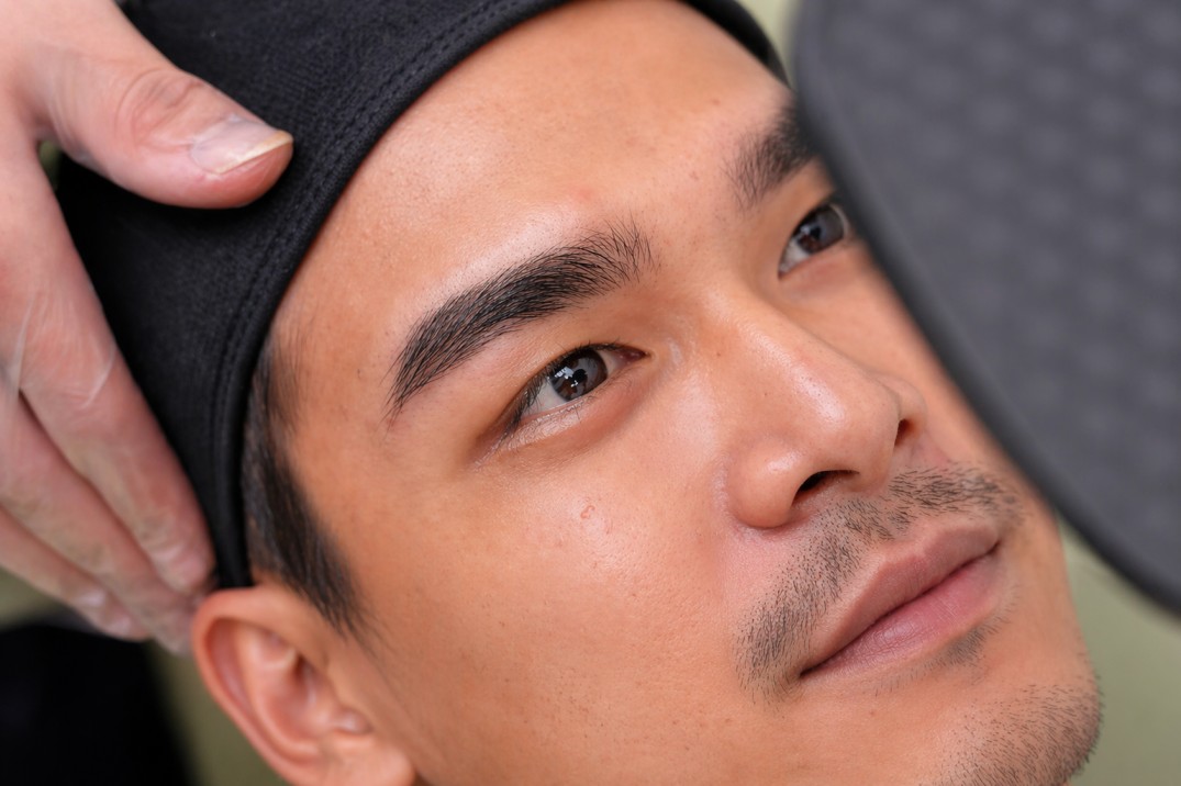 Eyebrow Restoration
