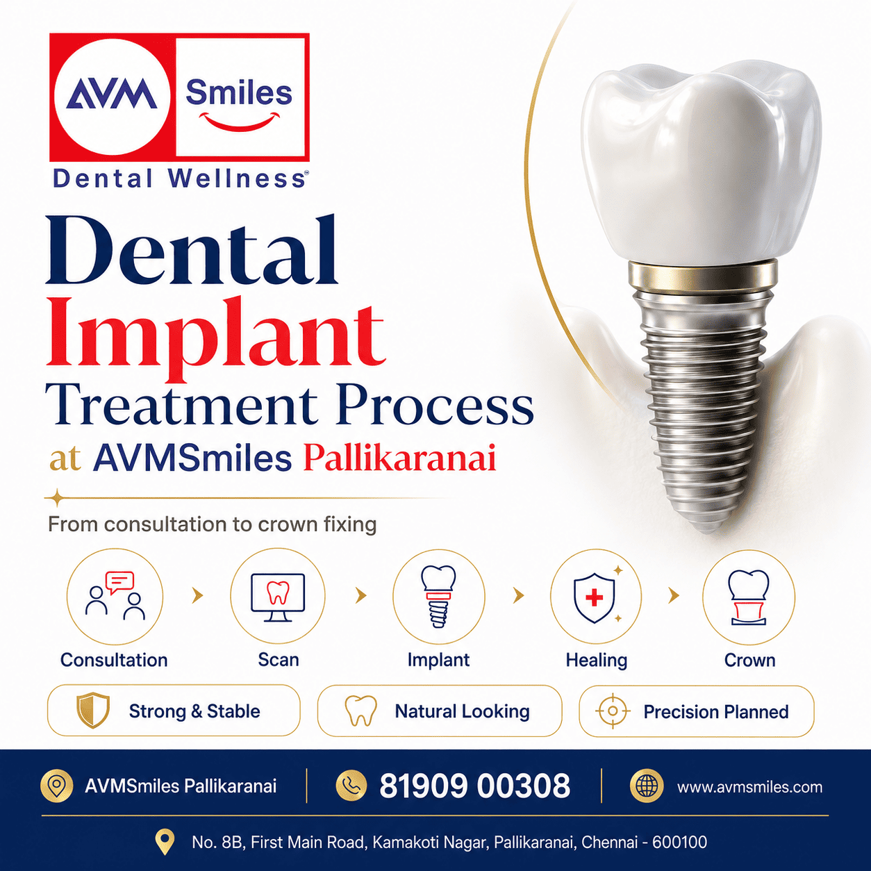 What Happens During a Root Canal Treatment? What Happens During a Root Canal Treatment?