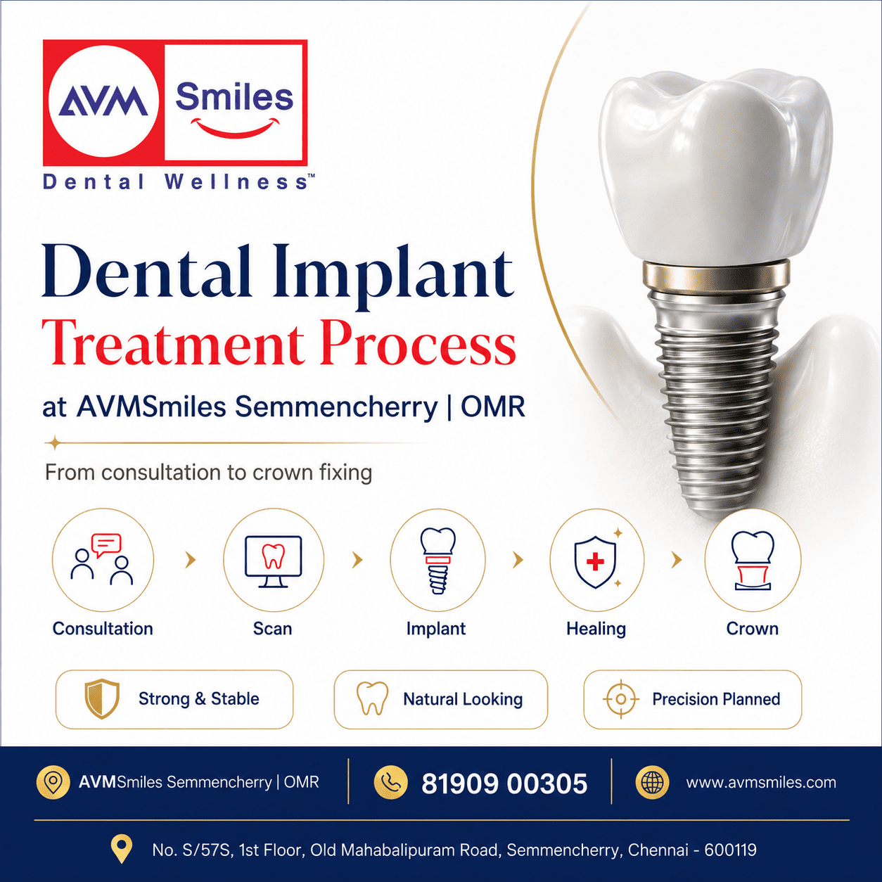 Understanding Root Canal Treatment: A Step-by-Step Guide in Semmencherry