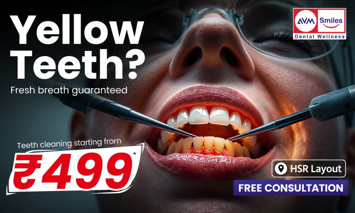 Best Teeth Cleaning in HSR Layout
