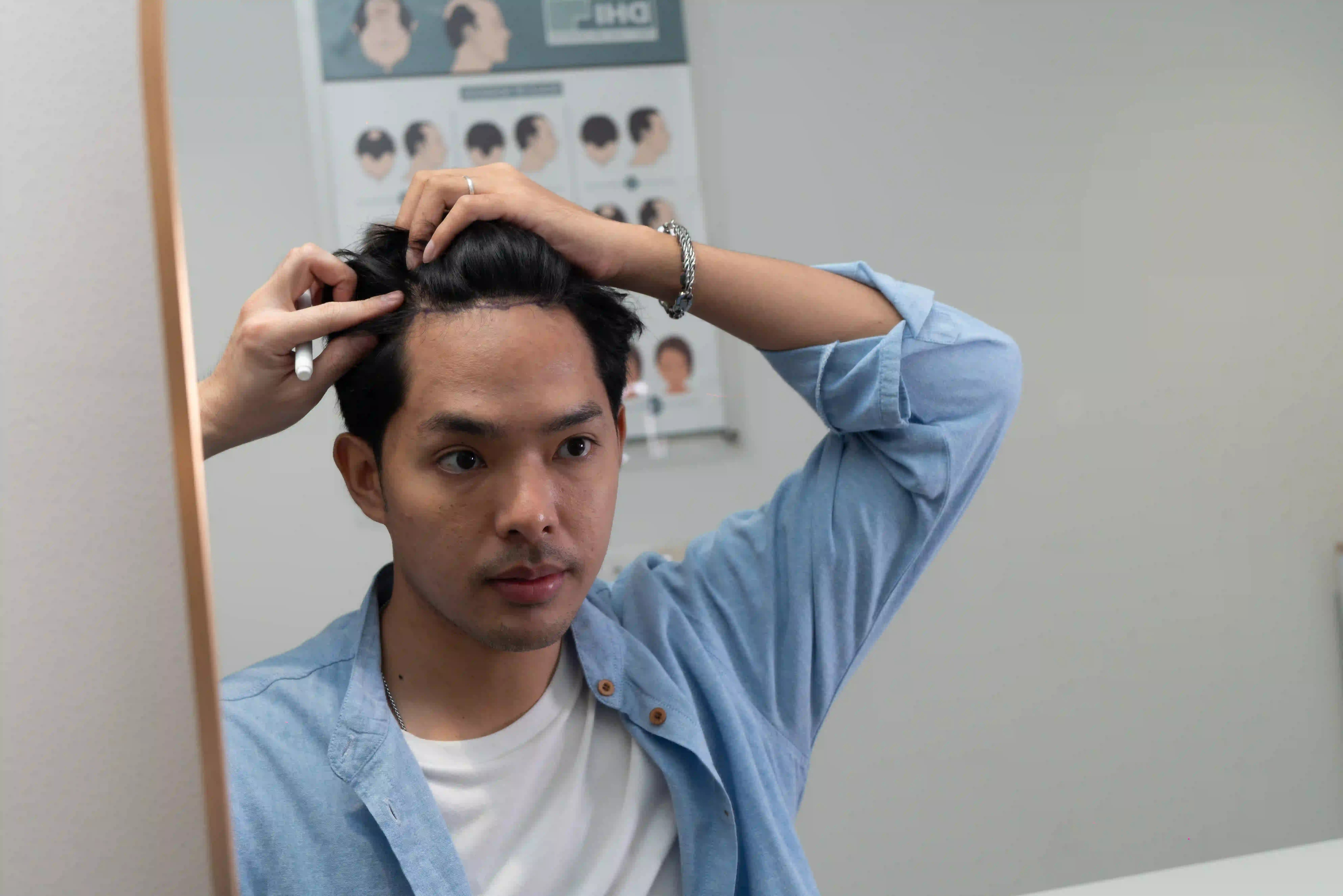 Hair Transplant