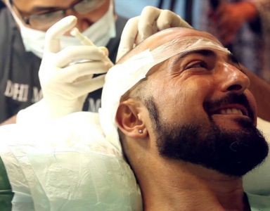 Direct Hair Implantation Category