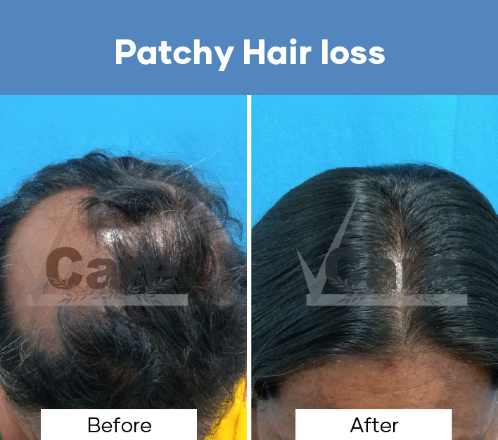 VCare Hair And Skin Clinic