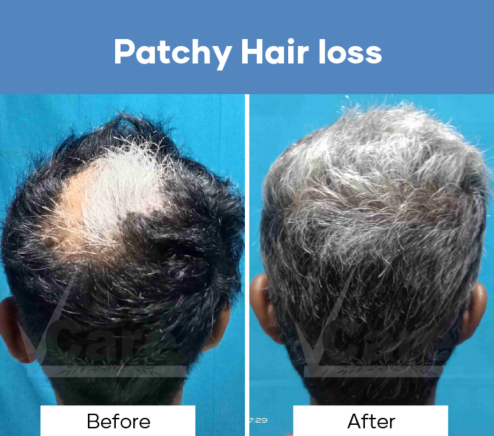 VCare Hair And Skin Clinic