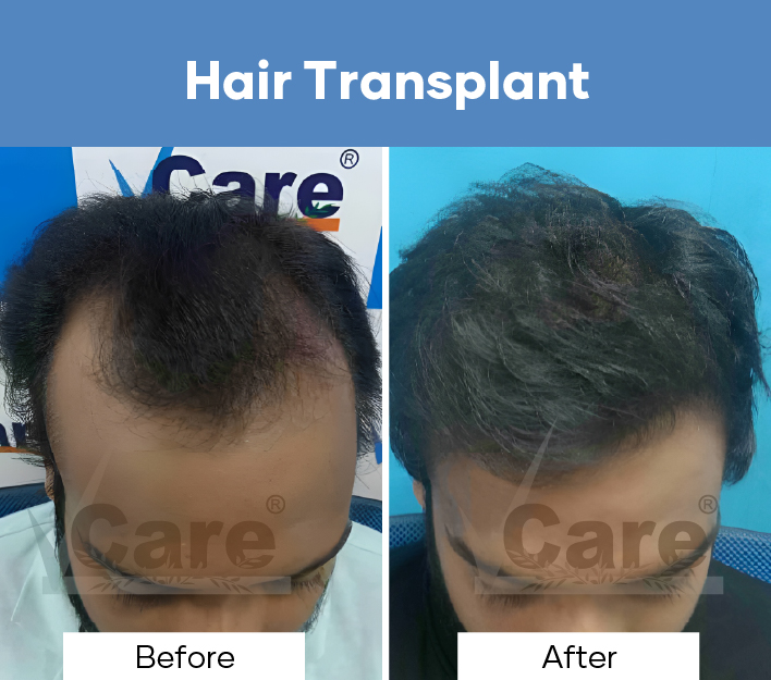 VCare Hair And Skin Clinic