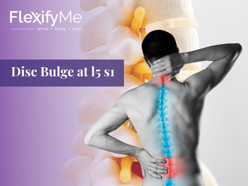 L5-S1 Disc Bulge: Symptoms, Causes and Treatment L5-S1 Disc Bulge: Symptoms, Causes and Treatment