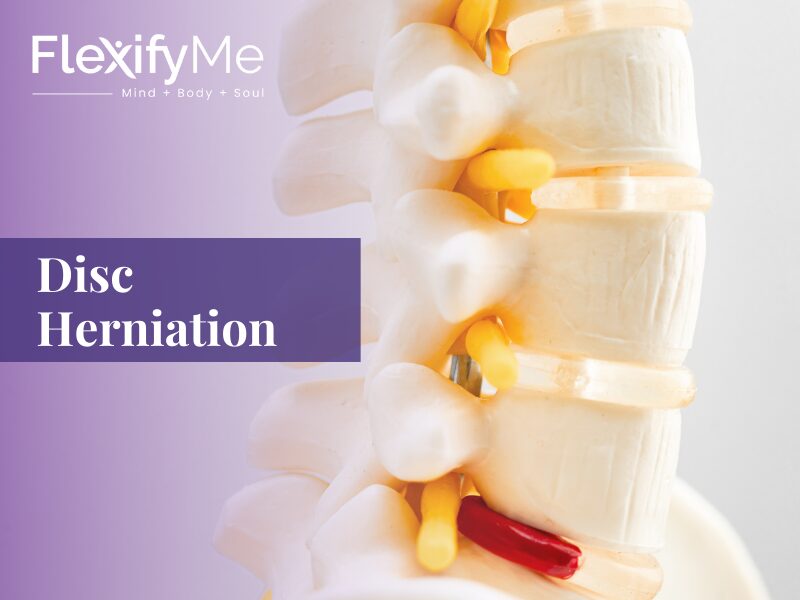Disc Herniation: What is it, Causes, Symptoms and Treatment