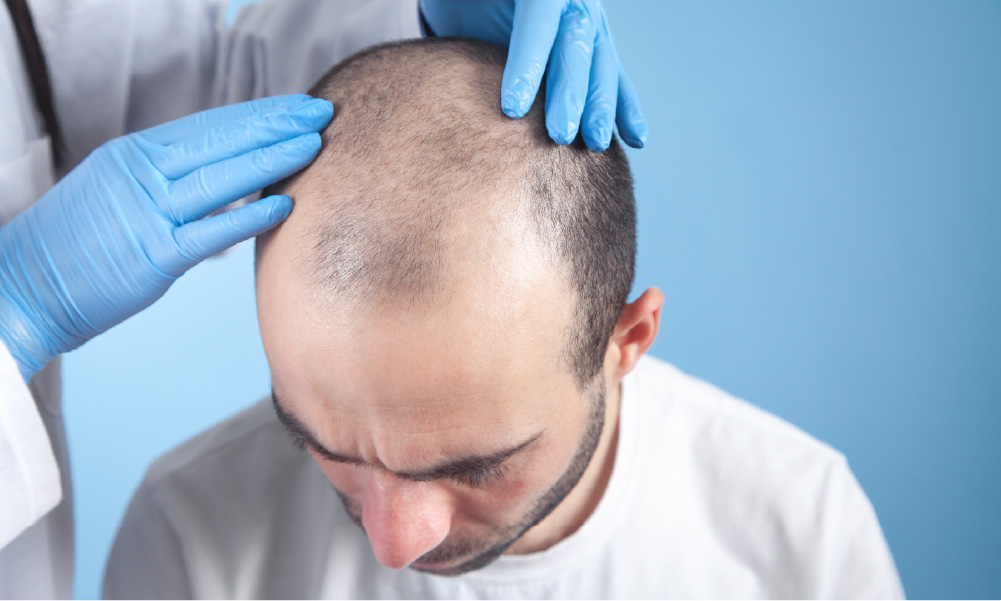 Losing More Hair Than Usual? A Dermatologist-Backed Guide to Hair Fall Treatment