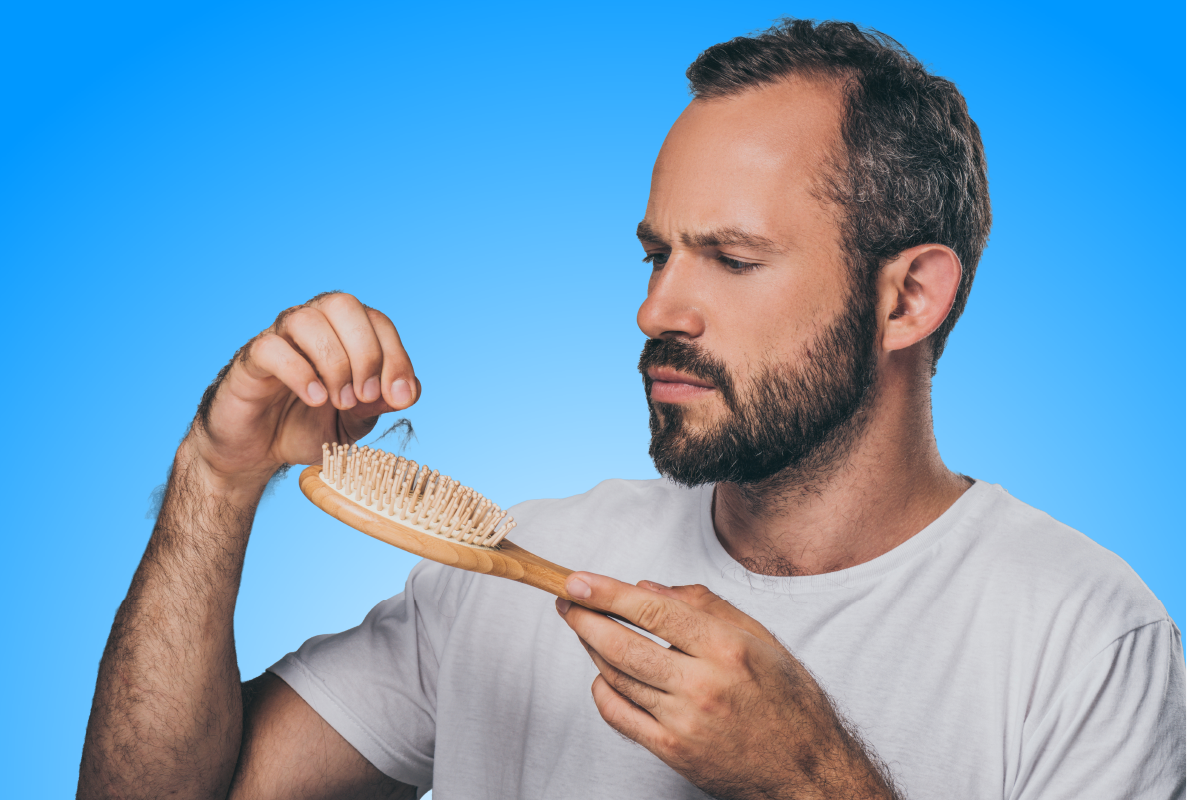 Hair Loss in men