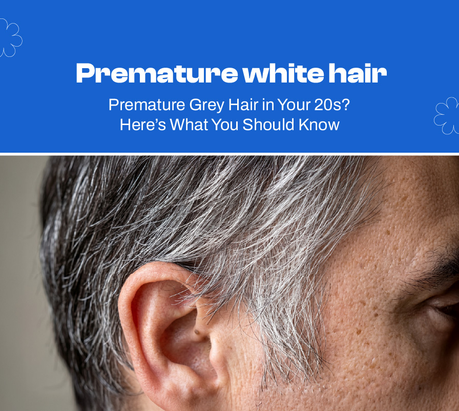 Dealing with Premature White Hair in the Early 20s
