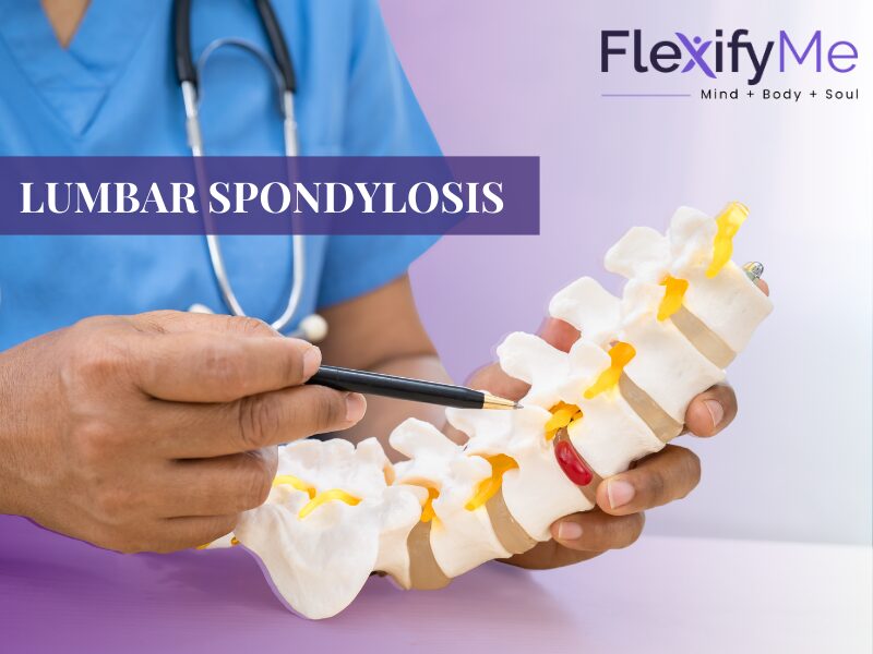 Lumbar Spondylosis: Symptoms, Causes And Treatment