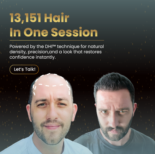 DHI™ Hair Transplant Clinic