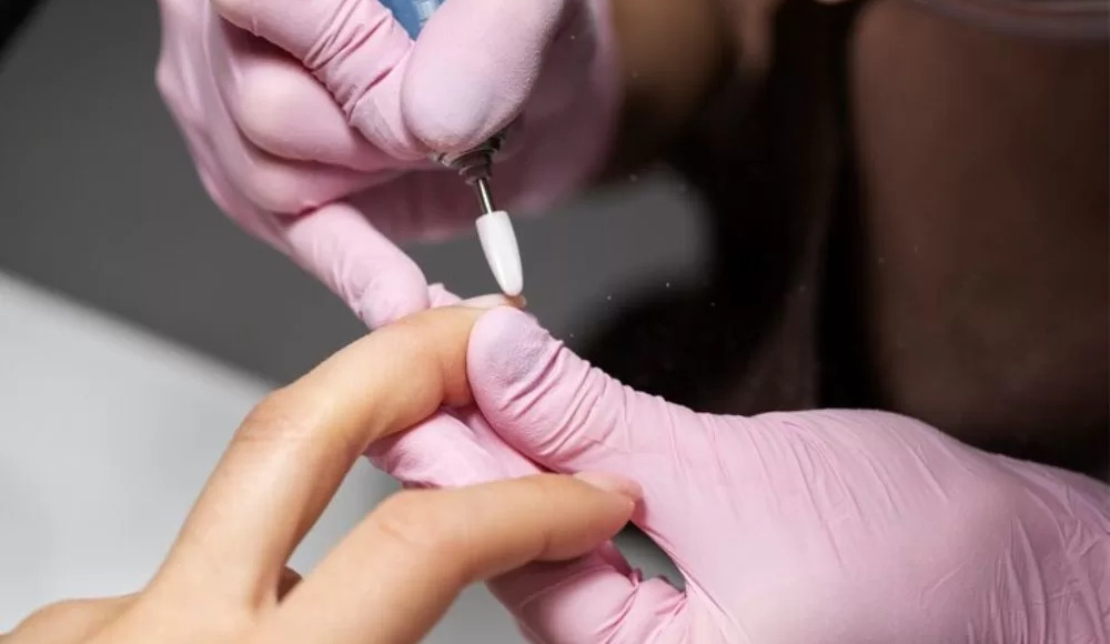 Nail Removal