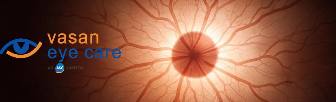 Best Eye Hospital in tirupati | Vasan Eye Care Hospital in Tata Nagar Best Eye Hospital in tirupati | Vasan Eye Care Hospital in Tata Nagar