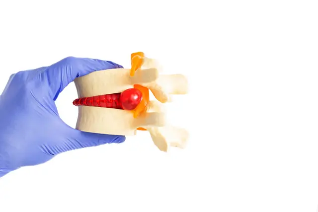 Slipped Disc Category