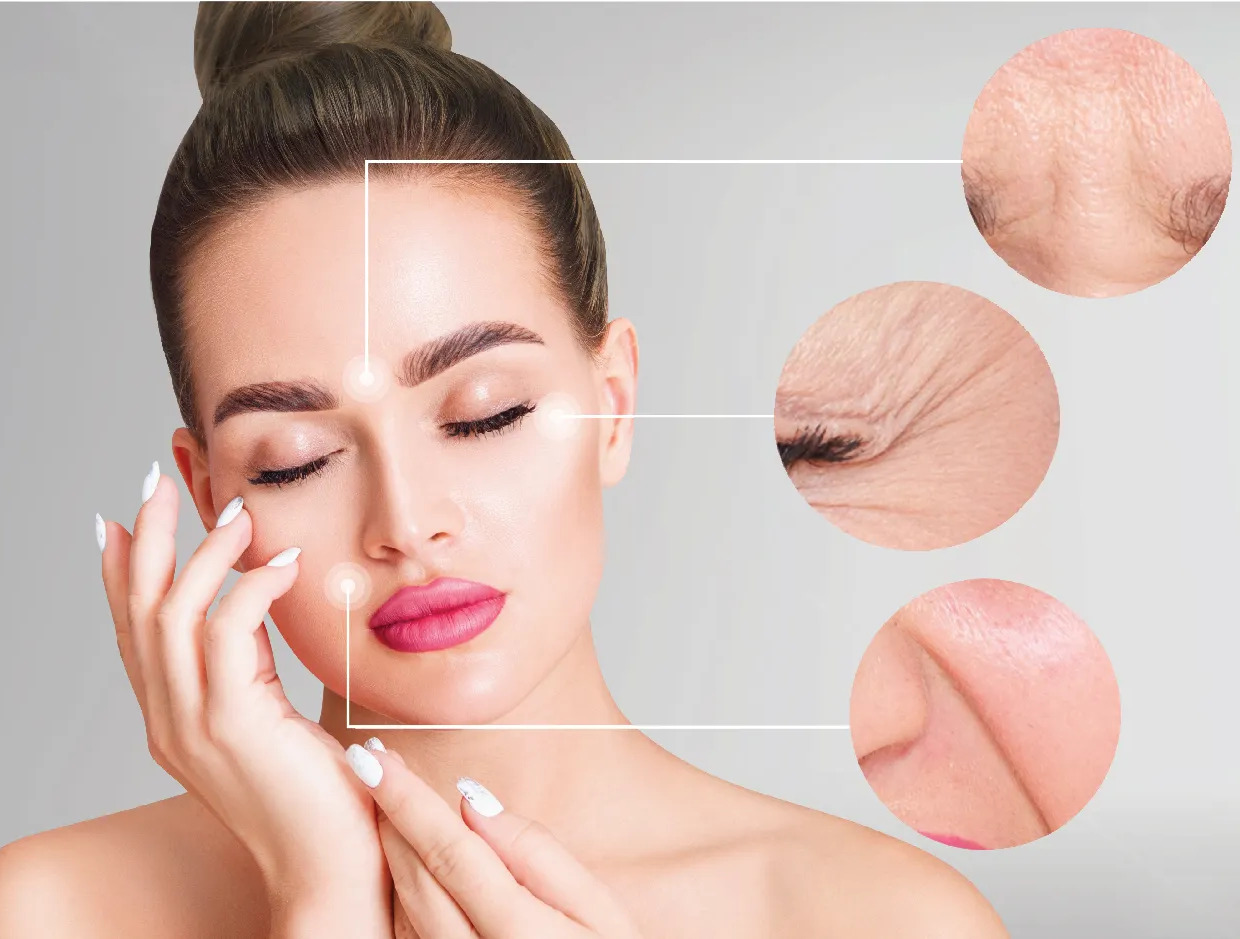 Thermage Treatment