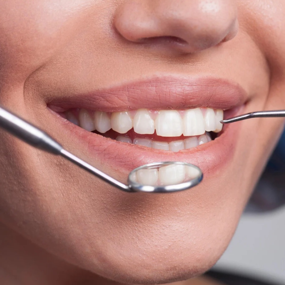 Smile Correction in Mallasandra, bengaluru: How It Works