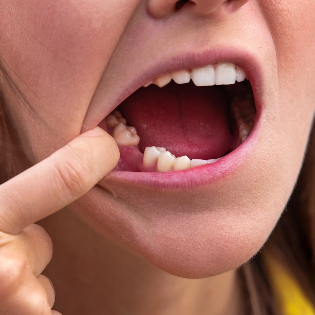 Dentist in Mallasandra, bengaluru: Care by Life Stage