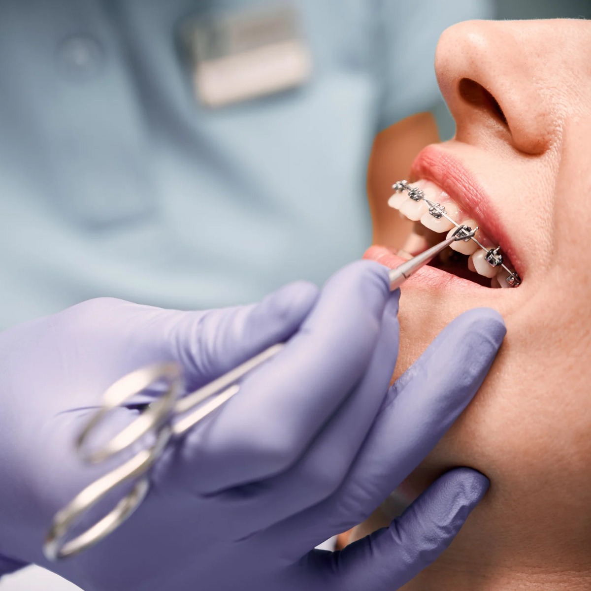 Orthodontist in Mallasandra, bengaluru: When to Consult
