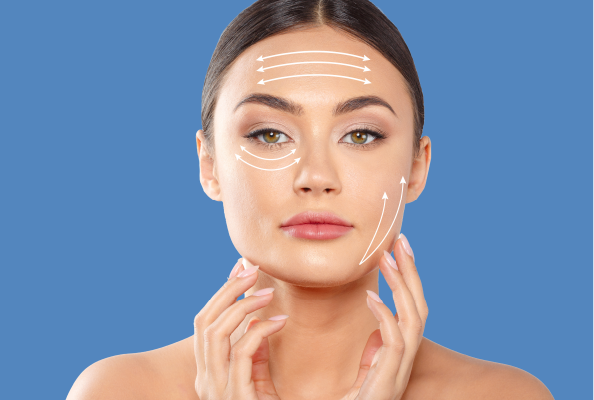 Thread facelift procedure