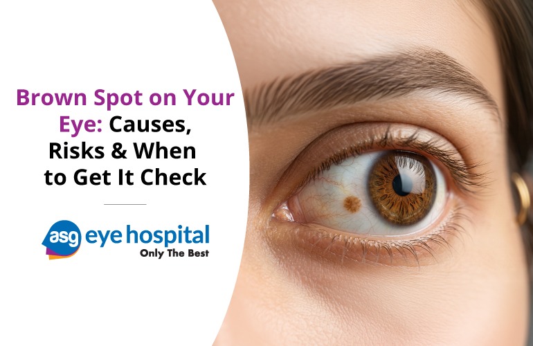 Brown Spot on Your Eye: Causes, Risks & When to Get It Checked in Jogeshwari West, mumbai