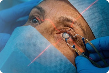 What Is Cataract Surgery in Ghatkopar West, mumbai? Procedure, Lens Types, and Cost Breakdown
