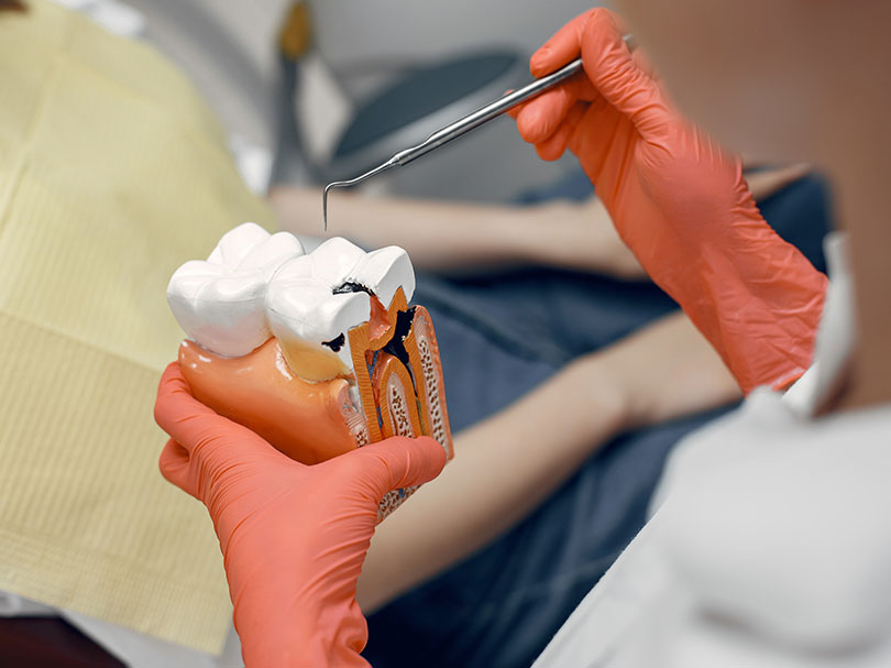 Pain-Free Root Canal Treatment: Expert Dental Care You Can Trust in Khadakpada, kalyan Pain-Free Root Canal Treatment: Expert Dental Care You Can Trust in Khadakpada, kalyan