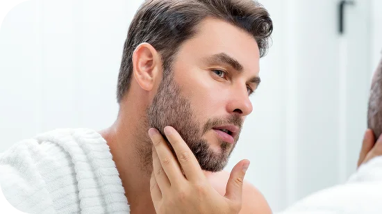 Beard Transplant