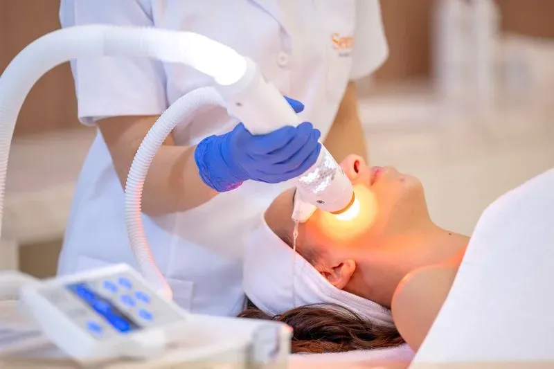 Aerolase Laser Treatment for Acne & Pigmentation