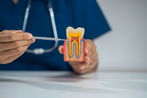 Root Canal Treatment