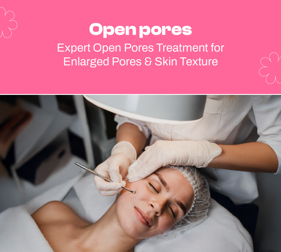 How to Get Rid of Open Pores: Causes, Treatments & Prevention