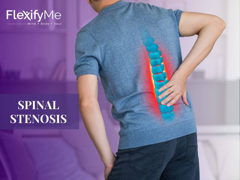 Spinal Stenosis: Causes, Symptoms & Treatment | Complete Guide – FlexifyMe
