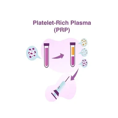 PRP Therapy