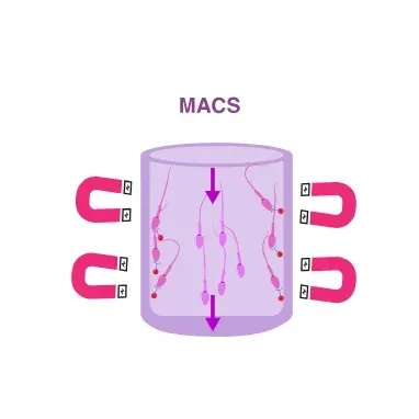 MACS