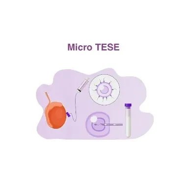Micro TESE